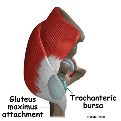 Bursitis of the Hip  Regenexx® Pittsburgh